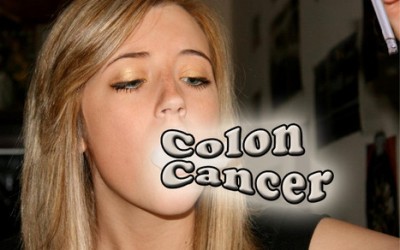 This One Is Completely Within Our Control…..Colon Cancer