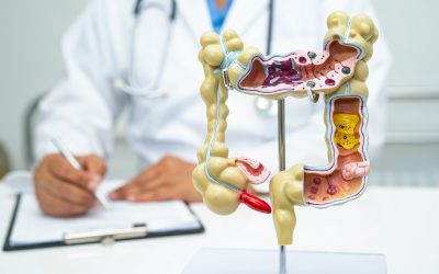 This One Is Completely Within Our Control…..Colon Cancer